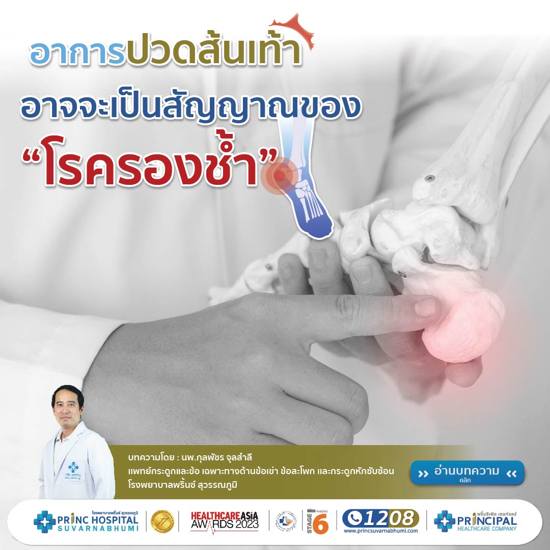 อาการปวดส้นเท้า อาจจะเป็นสัญญาณของโรครองช้ำ 