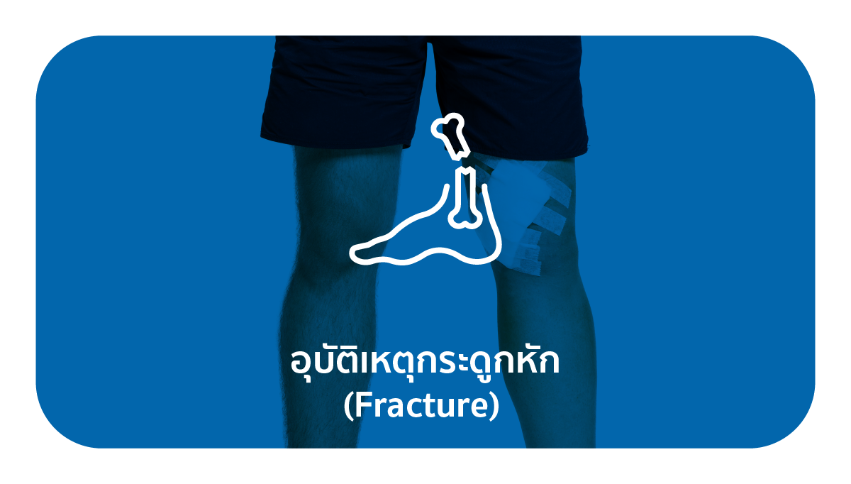 ให้การรักษาและดูแลผู้ที่มีกระดูกหักแบบซับซ้อนและรุนแรง หรือการแก้ไข   รักษาอาการกระดูกเชื่อมติดผิดรูป